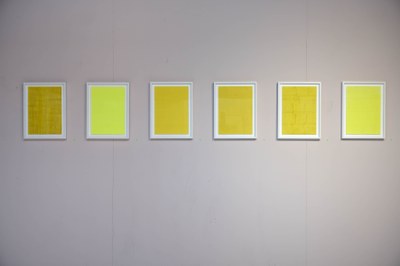 Repetitive Strain Injury